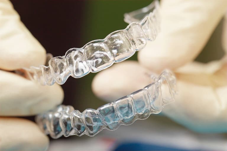 Torque con allineatori trasparenti: il materiale conta più del design